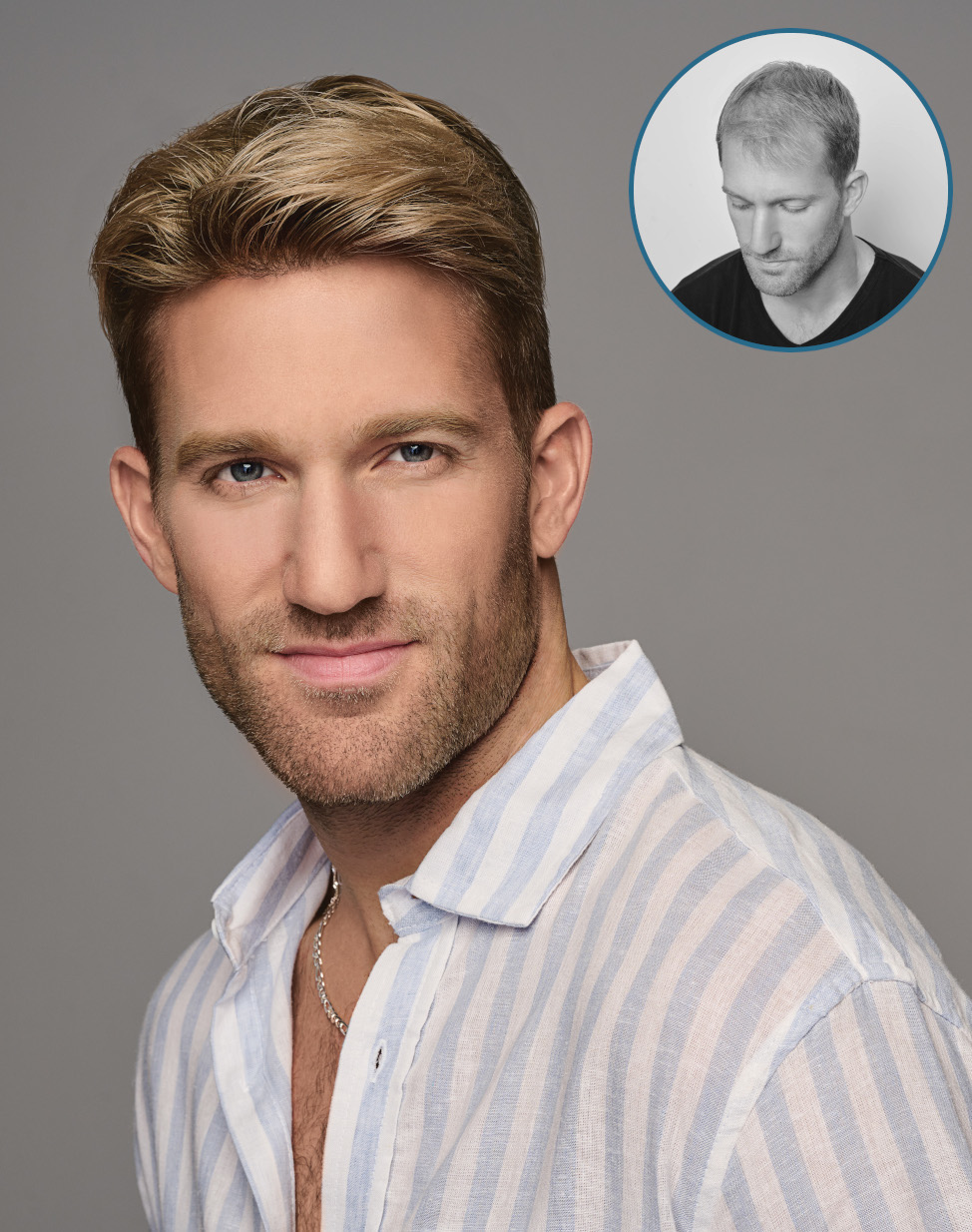 2_american_hairlines_mens_hair_loss_inset_974x1234