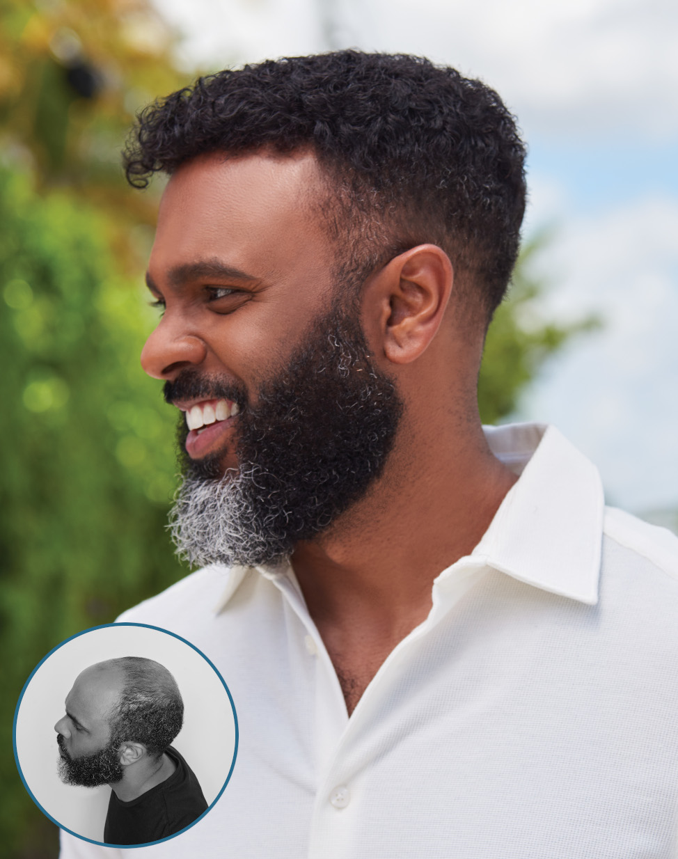 4_american_hairlines_mens_hair_loss_974x1234