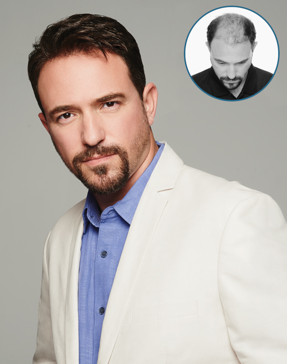 6_american_hairlines_mens_hair_loss_inset_974x1234